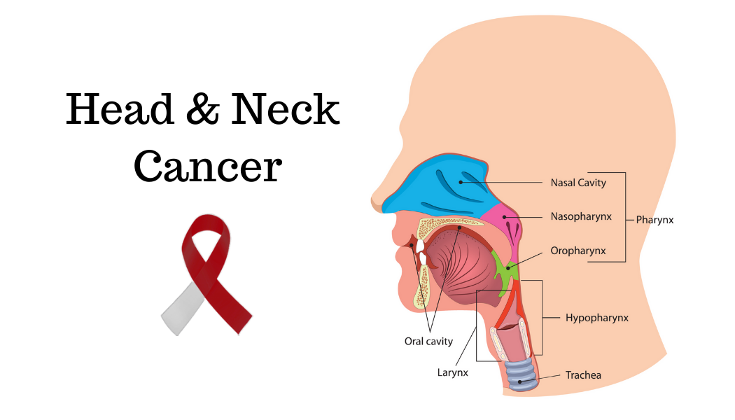 Head and Neck Cancer treatment in delhi, india